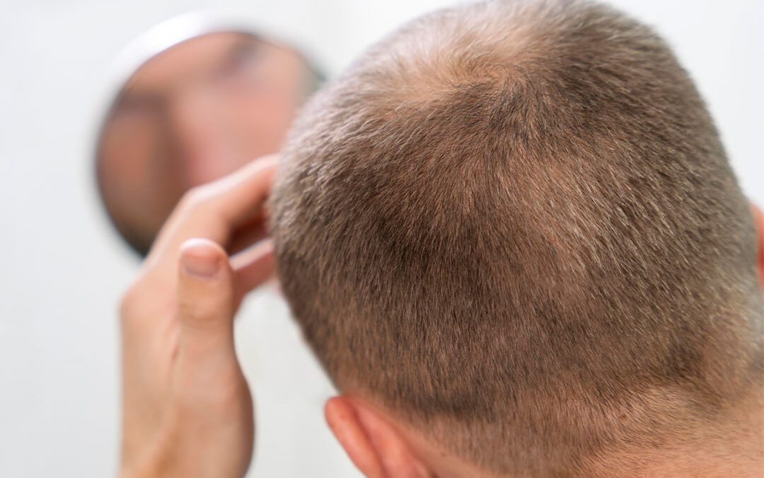 My Hair Regrowth Journey: An Honest Review